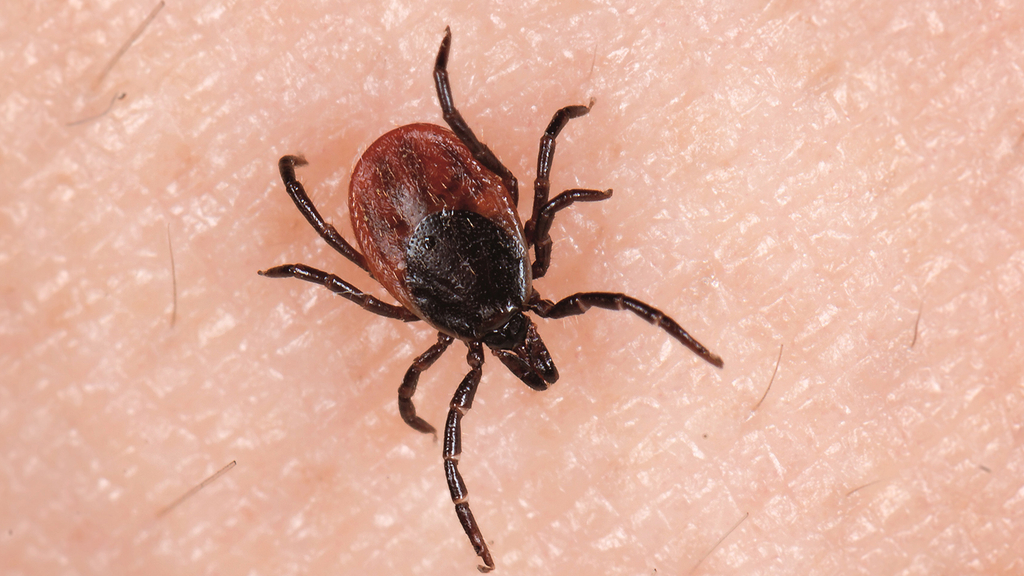 Vergrößerung des Bildes für Bild: Zecke auf der Haut.