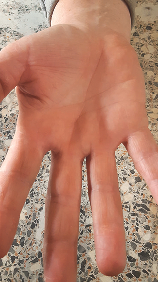 Vergrößerung des Bildes für Hand mit gesunder Haut.